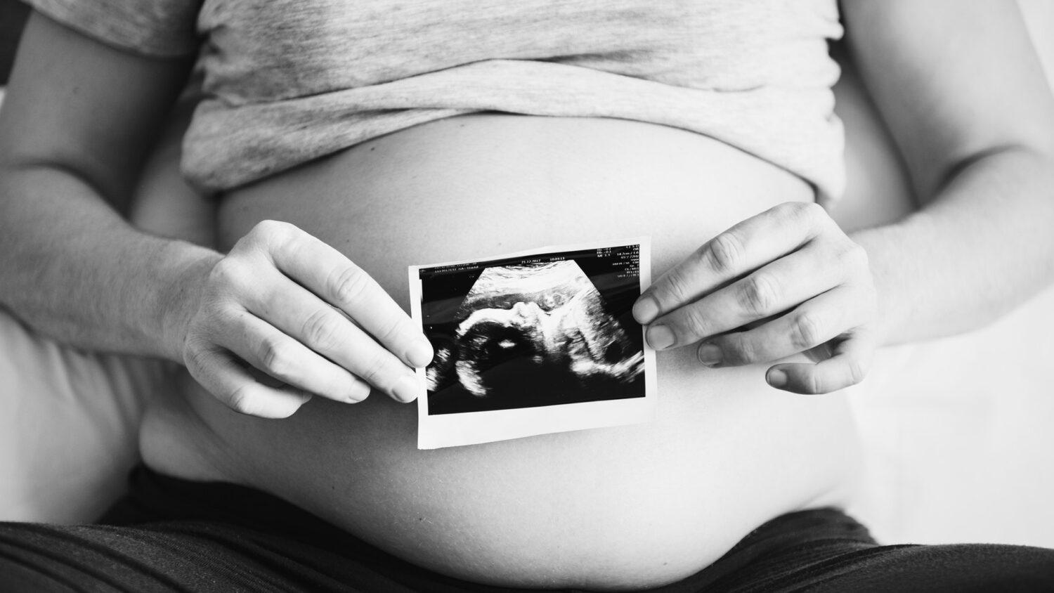 Margita Vanovčanová: Ochrana života nie je výsostná téma katolíkov