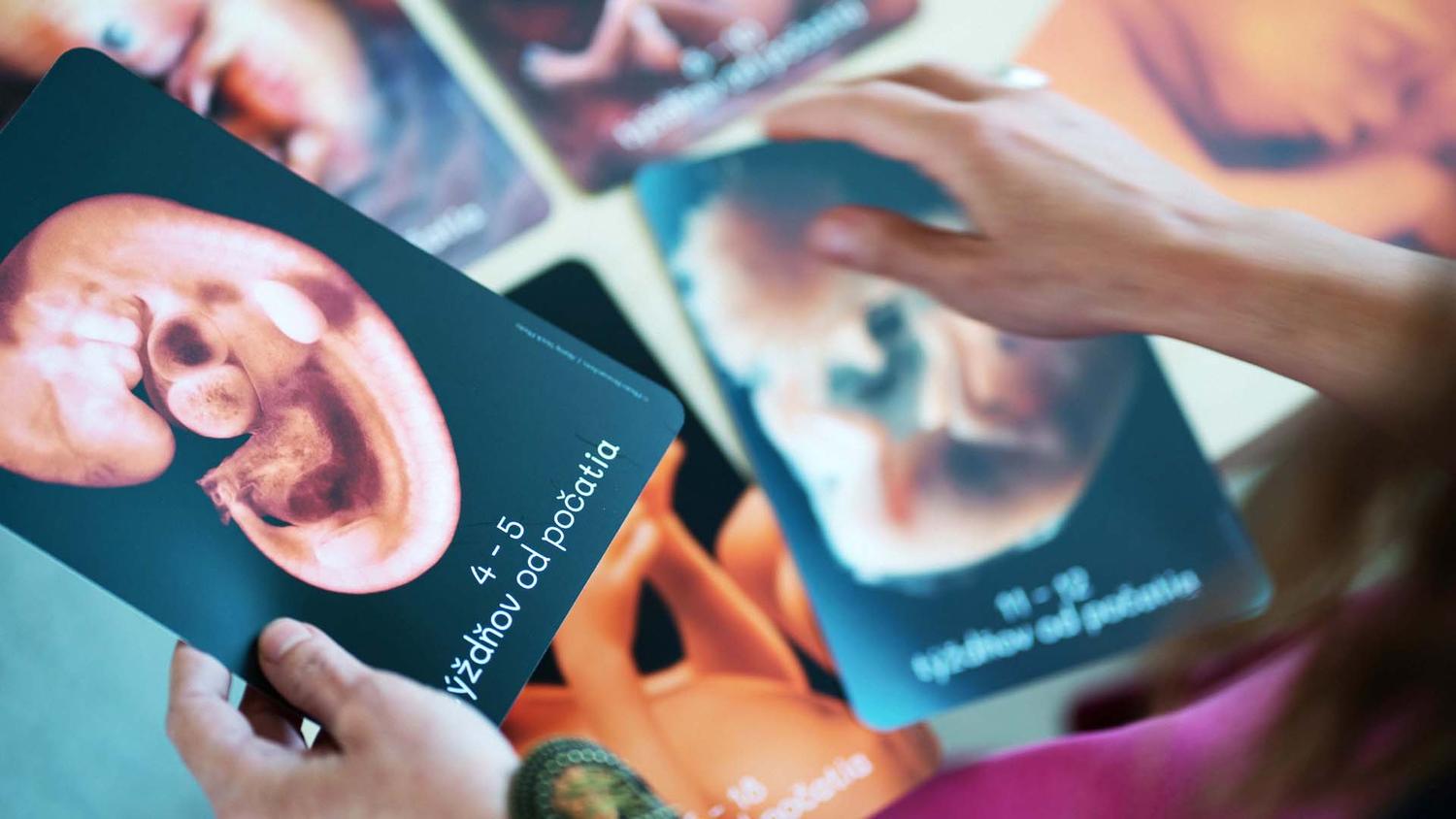 Edukatívna pomôcka Neviditeľný človek chce prekvapovať silou faktu