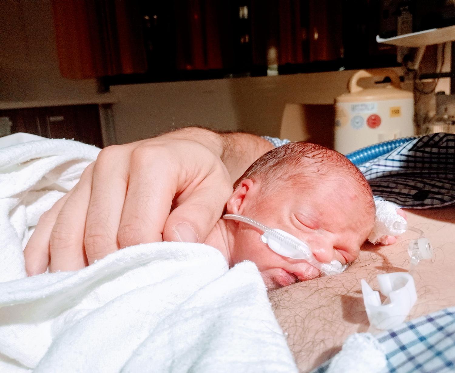 Mama Martina Chvojková: Ťažko sa mi prijímala realita, že náš vytúžený Joachim mohol zomrieť