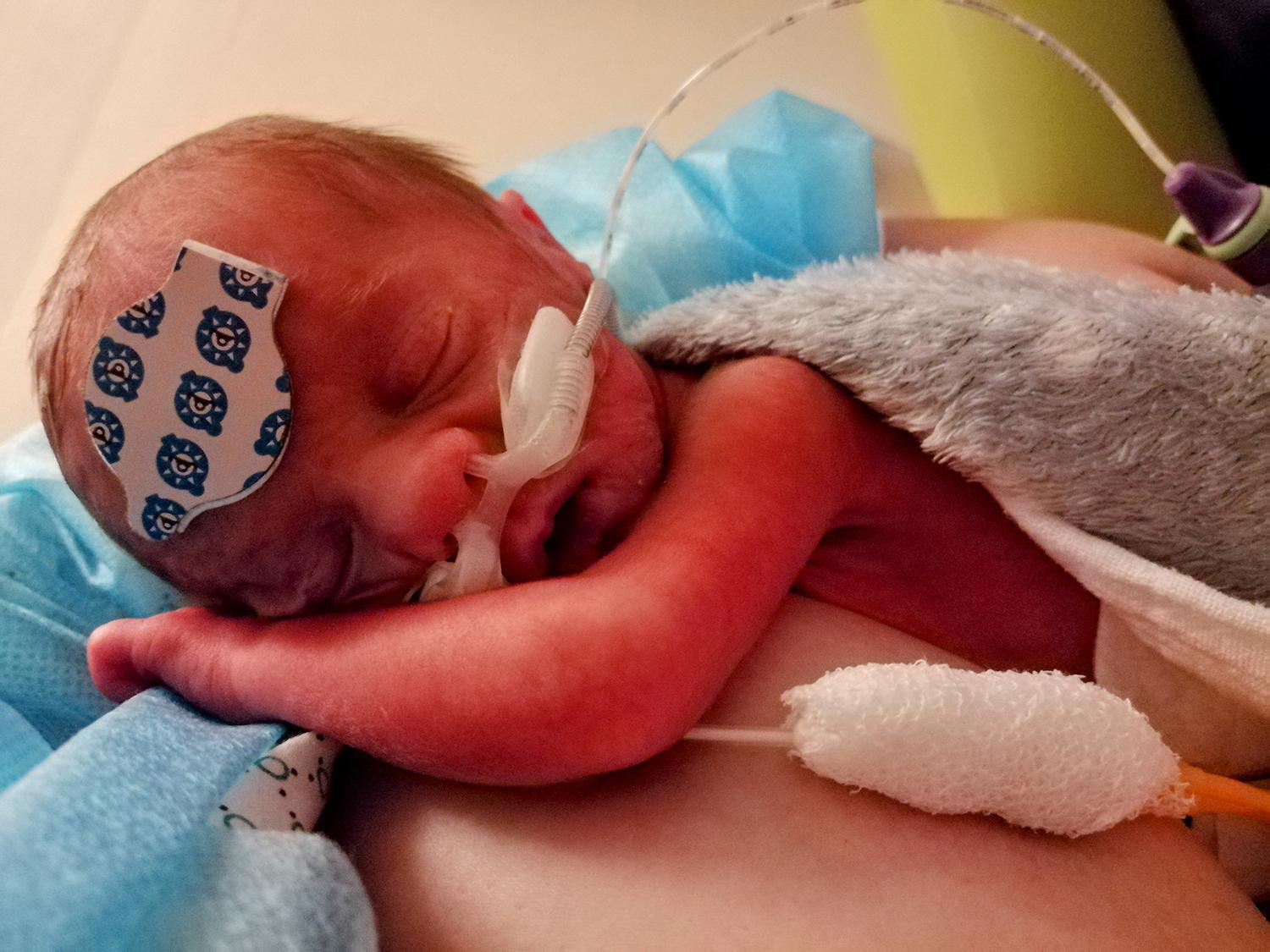 Mama Martina Chvojková: Ťažko sa mi prijímala realita, že náš vytúžený Joachim mohol zomrieť