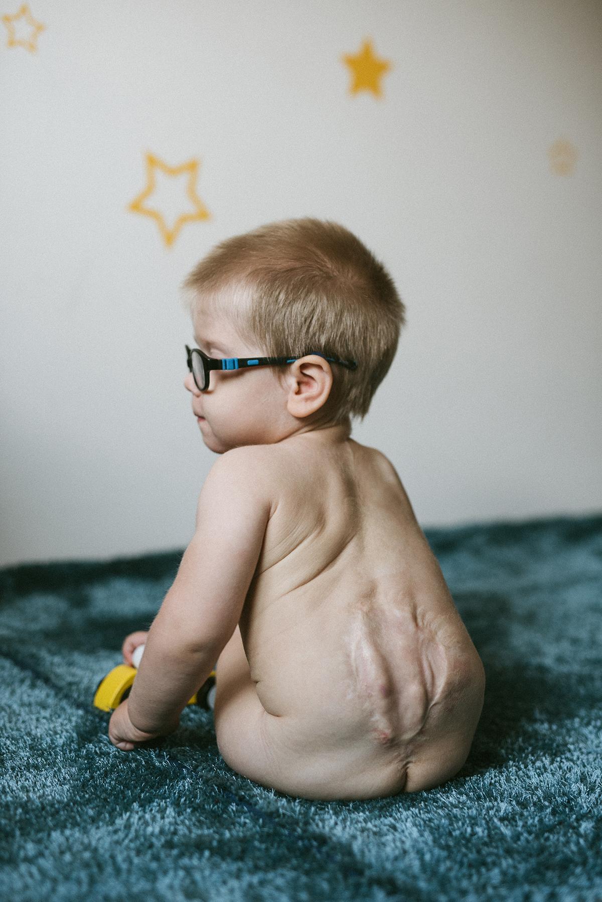 Svedectvo: Ani choré dieťa nám nevzalo lásku